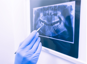 Dental X-Rays in Pell City, AL